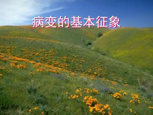 (医学课件)呼吸ppt课件