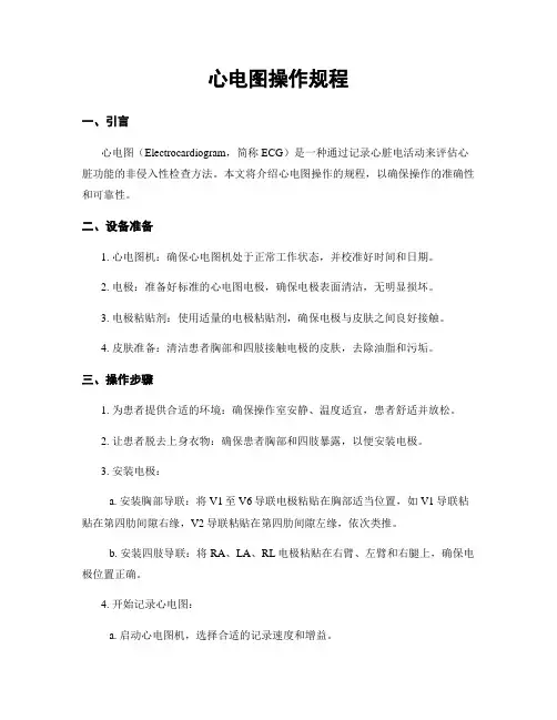 心电图操作规程