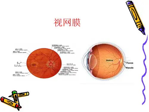视网膜病