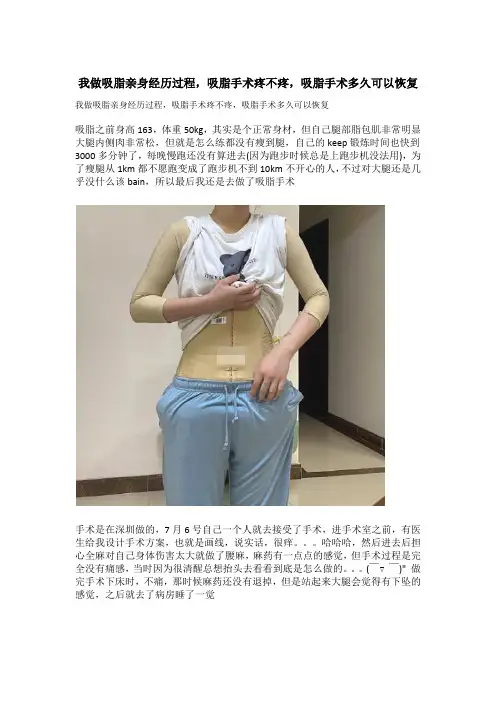 我做吸脂亲身经历过程,吸脂手术疼不疼,吸脂手术多久可以恢复