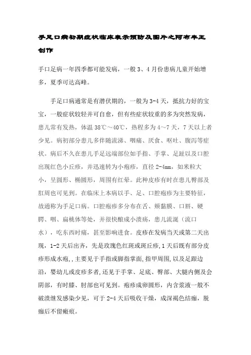 手足口病初期症状及图片-手足口病症状图片