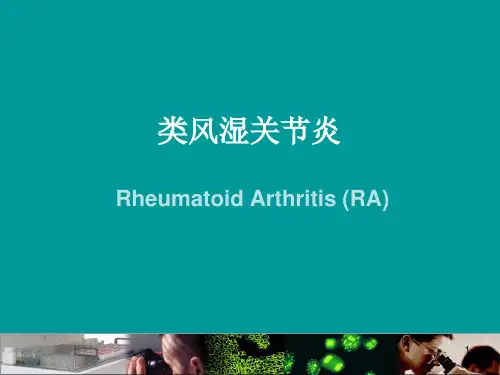 类风湿关节炎自身抗体[荟萃精制]