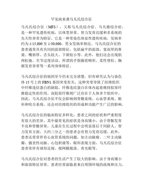 罕见病来袭马凡氏综合征