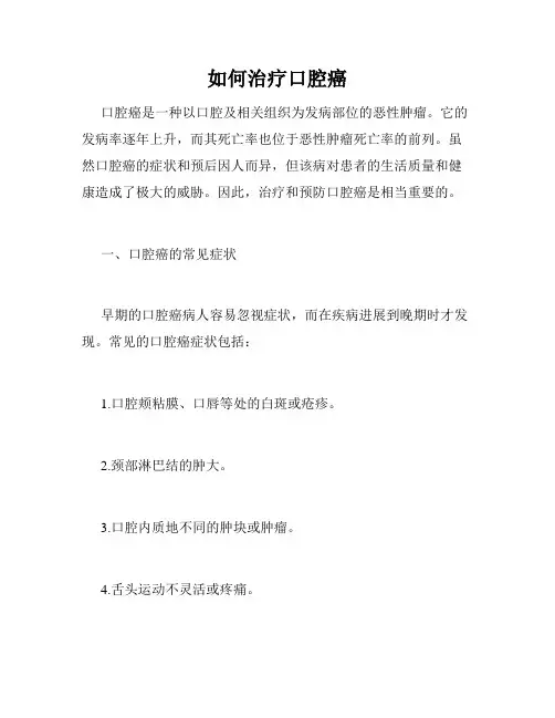 如何治疗口腔癌