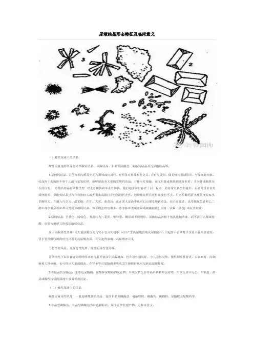 尿液结晶形态特征及临床意义