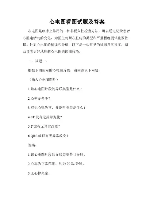 心电图看图试题及答案