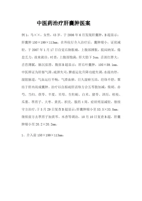中医药治疗肝囊肿医案