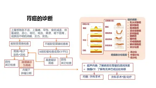 胃癌的诊断(图解)