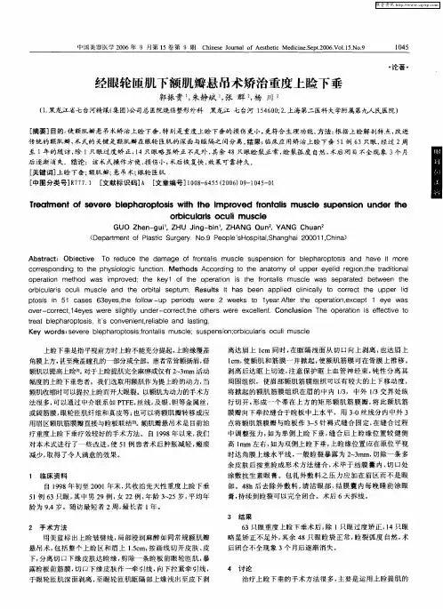 经眼轮匝肌下额肌瓣悬吊术矫治重度上睑下垂