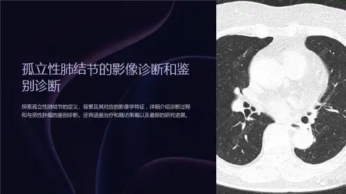 孤立性肺结节的影像诊断和鉴别诊断
