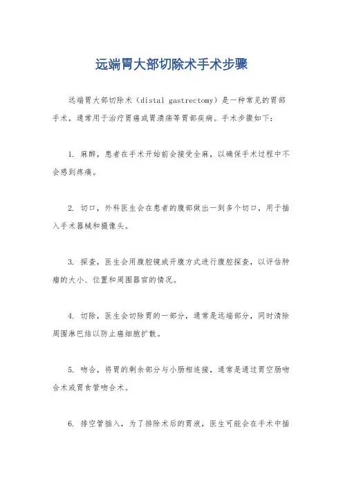 远端胃大部切除术手术步骤