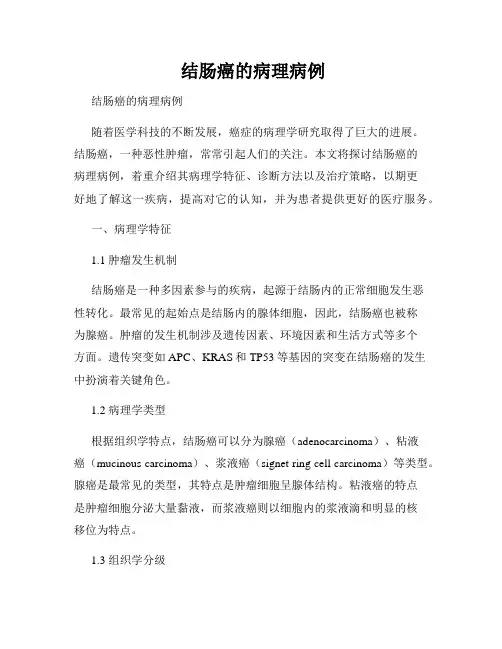 结肠癌的病理病例