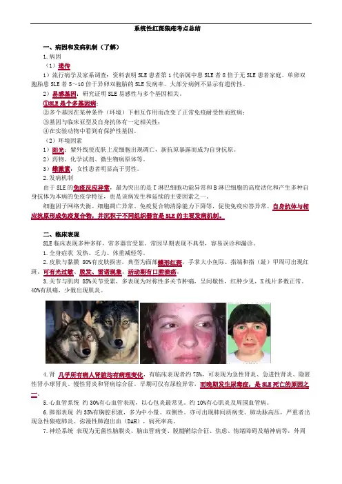 系统性红斑狼疮考点总结