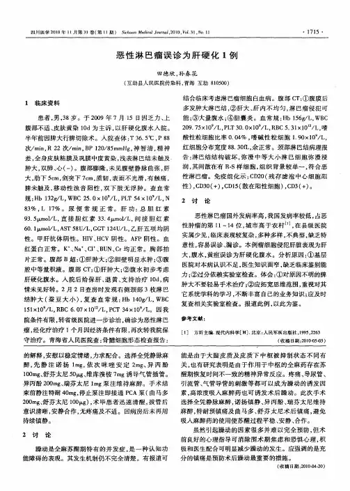 恶性淋巴瘤误诊为肝硬化1例