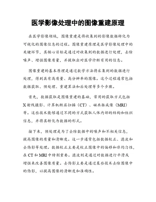 医学影像处理中的图像重建原理