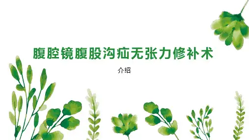 腹腔镜腹股沟疝无张力修补术