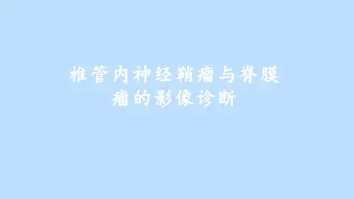 神经鞘瘤与脊膜瘤影像