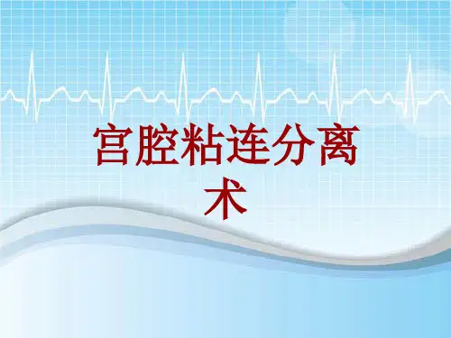 手术讲解模板：宫腔粘连分离术