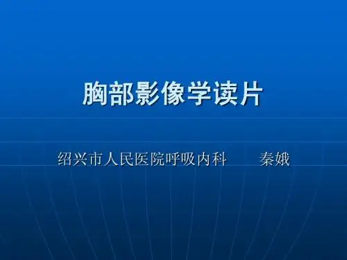 胸部影像学读片2