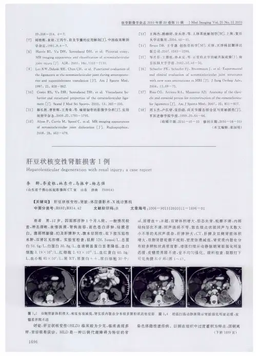 肝豆状核变性肾脏损害1例