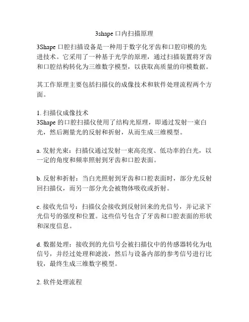 3shape口内扫描原理