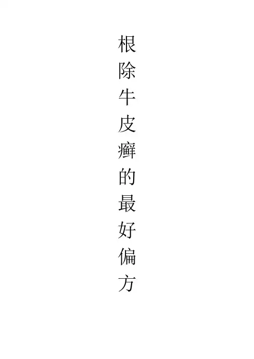 根除牛皮癣的最好偏方@