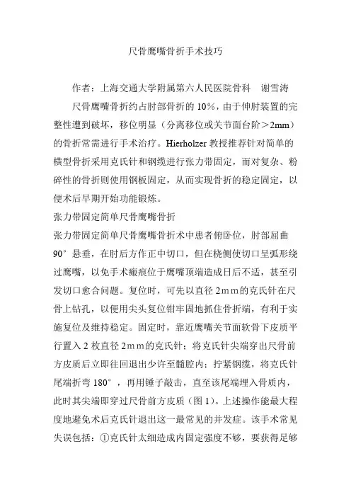 尺骨鹰嘴骨折手术技巧