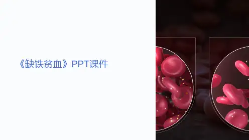 《缺铁贫血》课件