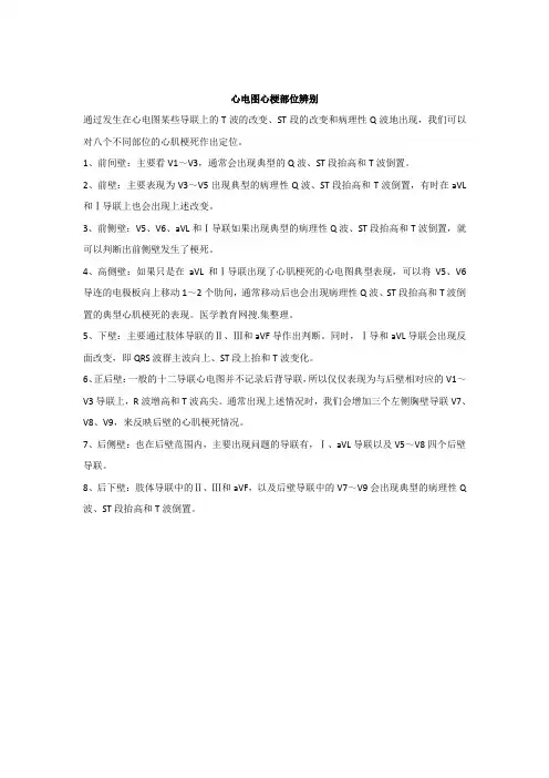 心电图心梗部位辨别