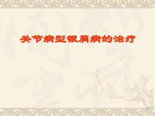 关节病型银屑病的治疗PPT课件