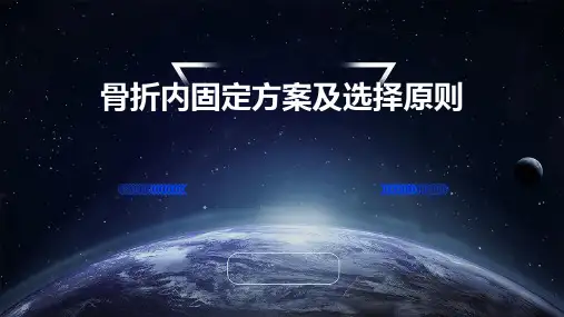 骨折内固定方案及选择原则