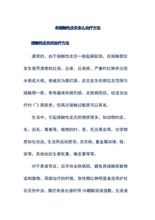 有接触性皮炎怎么治疗方法