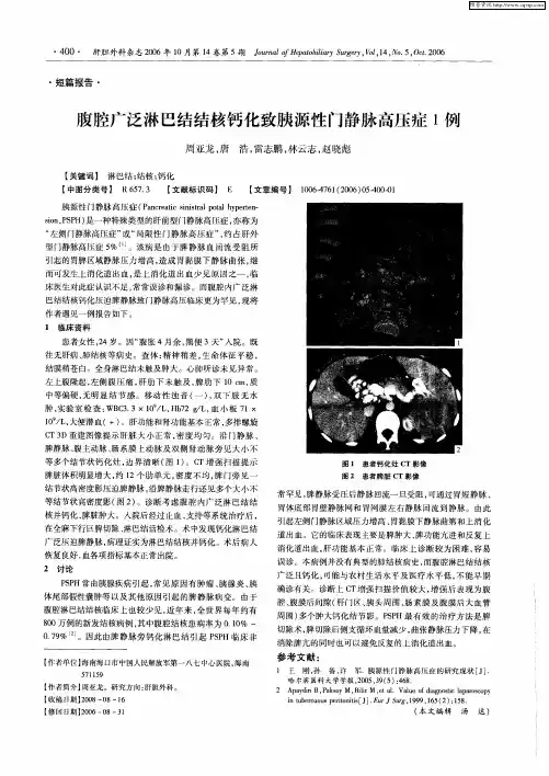 腹腔广泛淋巴结结核钙化致胰源性门静脉高压症1例