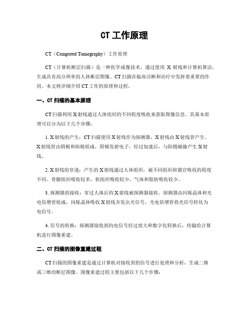 CT工作原理