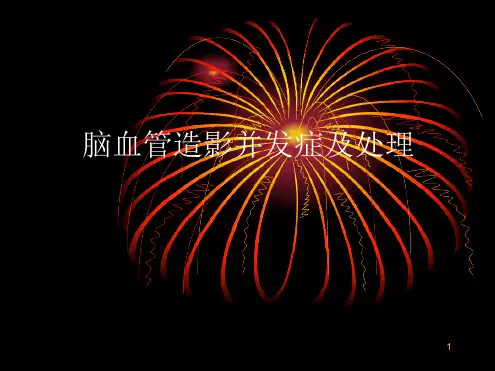 脑血管造影并发症及处理参考幻灯片