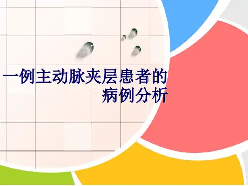 病例分析：主动脉夹层