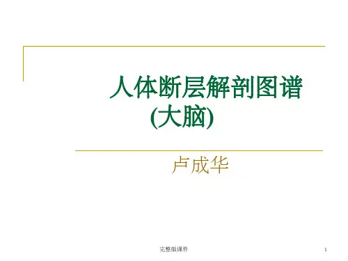 人体断层解剖图谱(大脑)ppt课件精选ppt