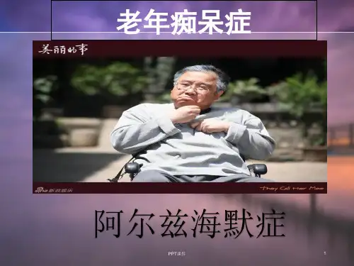 pbl阿尔兹海默症-老年痴呆护理  ppt课件