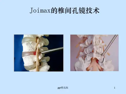 椎间孔镜手术操作方法ppt课件