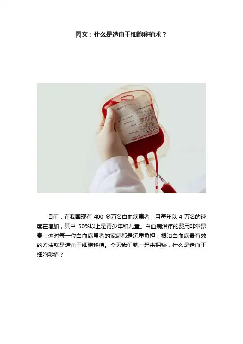 图文：什么是造血干细胞移植术？
