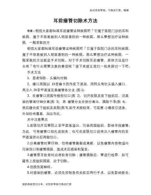 耳前瘘管切除术方法