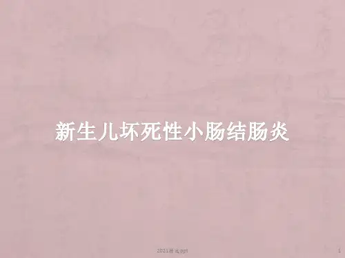 新生儿坏死性小肠结肠炎NEC护理常规ppt课件