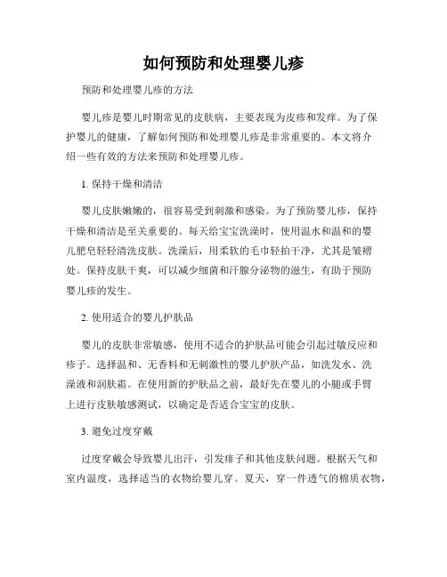 如何预防和处理婴儿疹