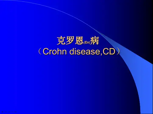 克罗恩病临床表现诊断介绍ppt