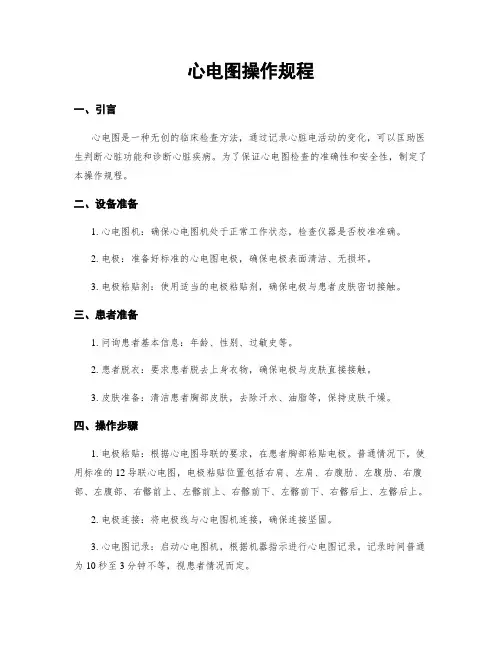 心电图操作规程