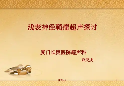 神经鞘瘤PPT课件