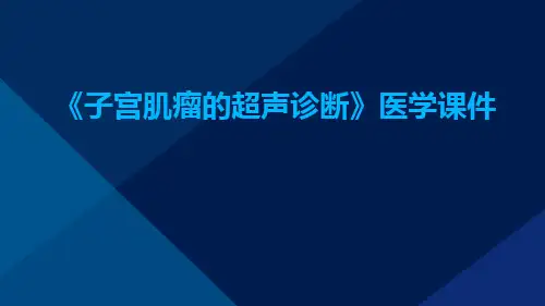 子宫肌瘤的超声诊医学课件