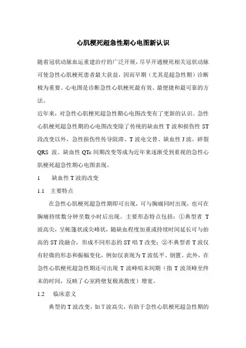 心肌梗死超急性期心电图新认识
