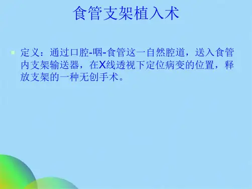 食管癌支架置入术后护理(共43张PPT)