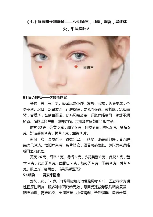 （七）麻黄附子细辛汤——少阴肿痛，目赤，咽炎，扁桃体炎，甲状腺肿大